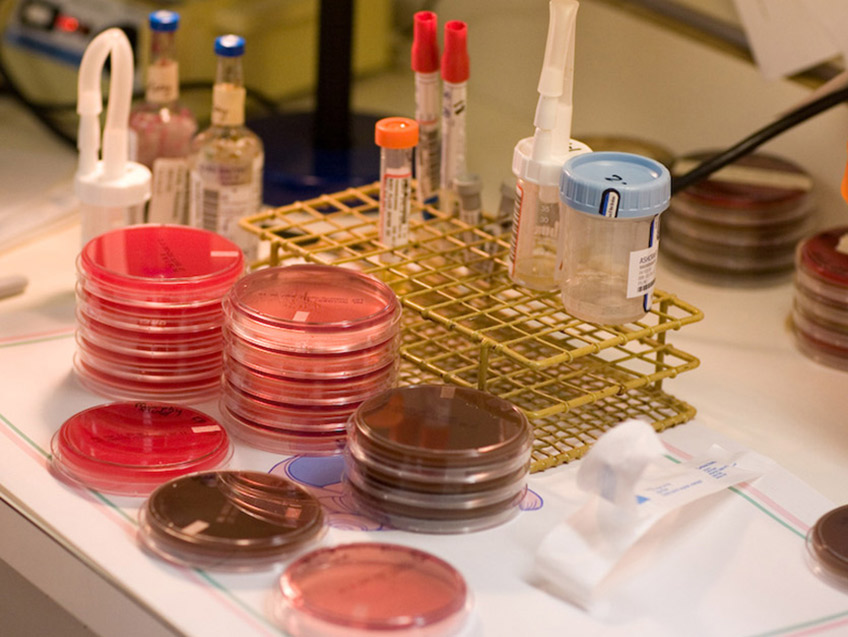 Microbiology set up station - showing plates and specimens.