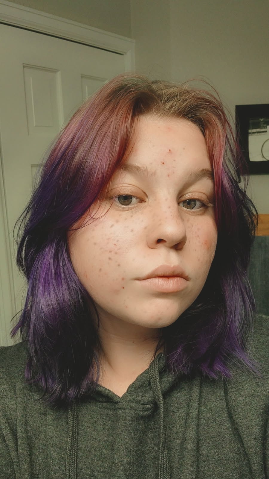Cass with freckles and hair fading from mauve to dark purple to black. Not smiling. Wearing a dark green hoodie