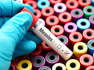 Blood sample vile with Measles on its label