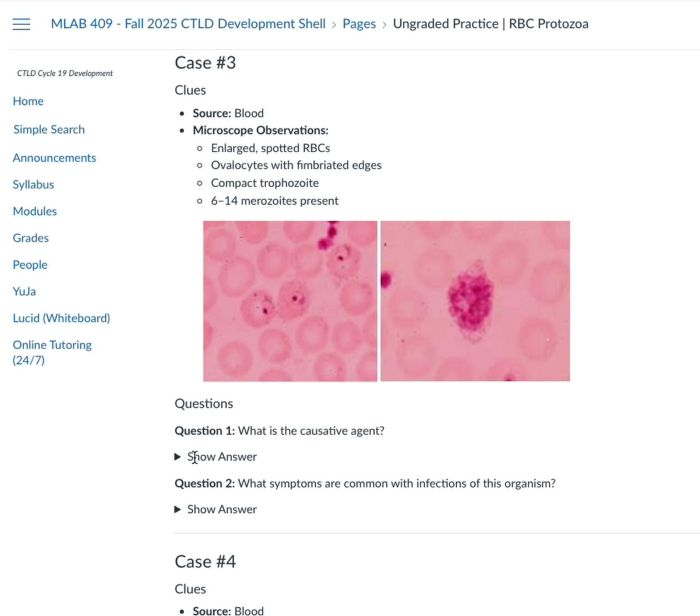 A Canvas page view of parasitology cases from the course MLAB 409